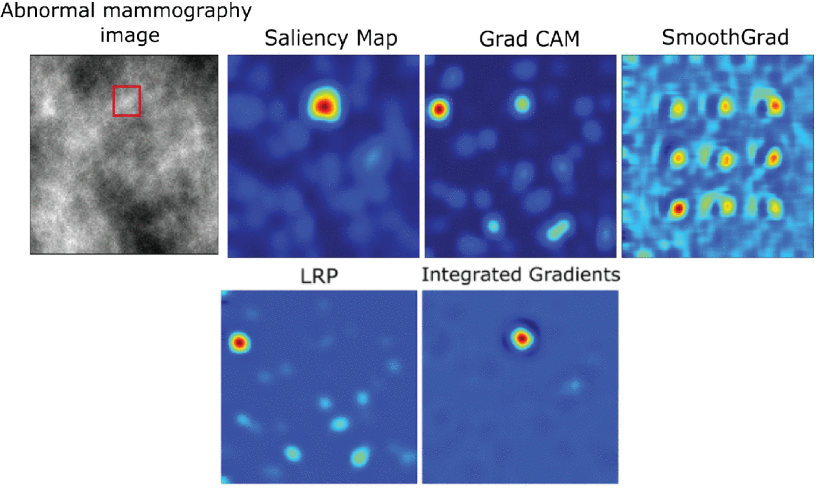 Heatmap interpretations generated by different post-hoc interpretability methods for the baseline CNN classifier. Source: https://shorturl.at/0oRS8