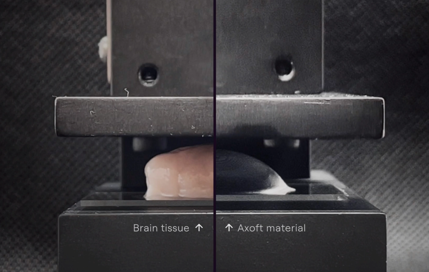 [Axoft’s](https://axoft.us/) implant mimics the soft tissues which surround it while maintaining resilience against the harsh conditions of the brain.