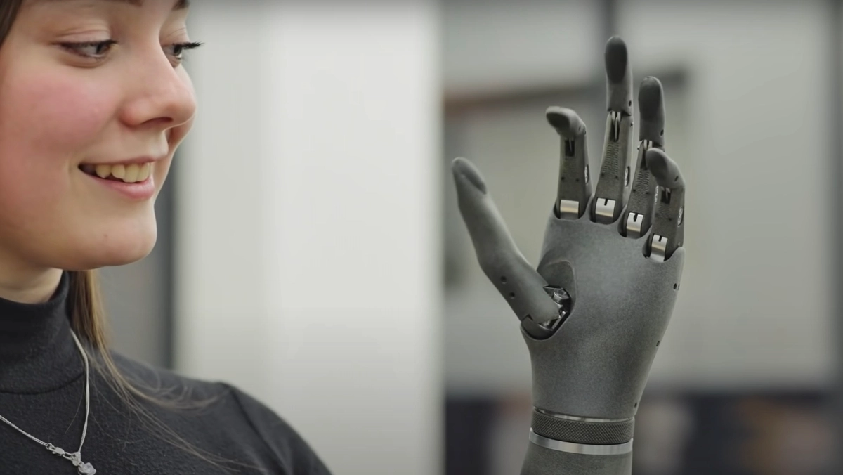 [Esper Bionics](https://esperbionics.com/) prosthetic arm.